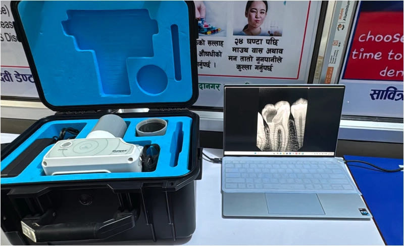 Digital X-Ray Technology